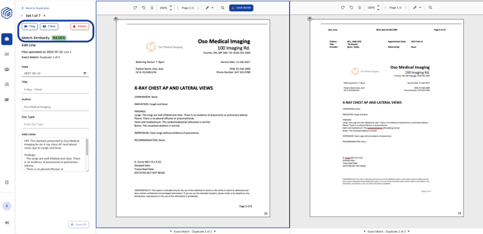 Dupes - Match Similarity