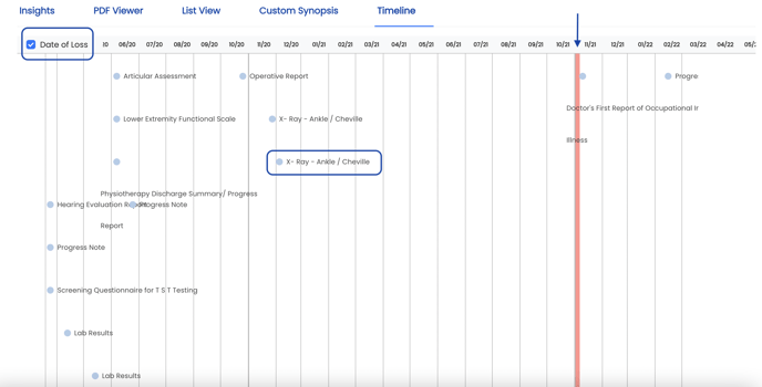 Timeline View